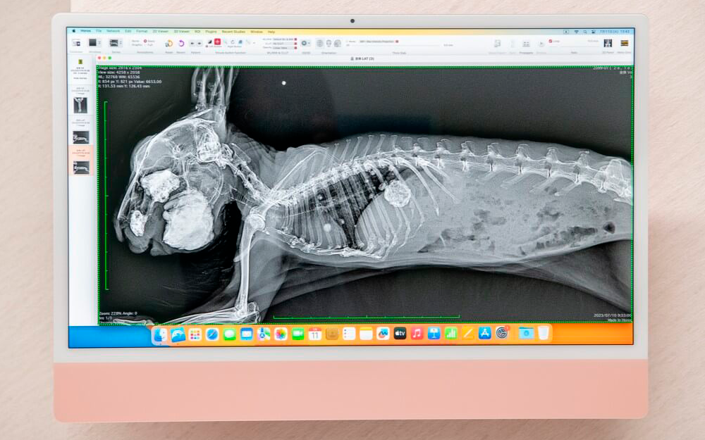 レントゲン写真